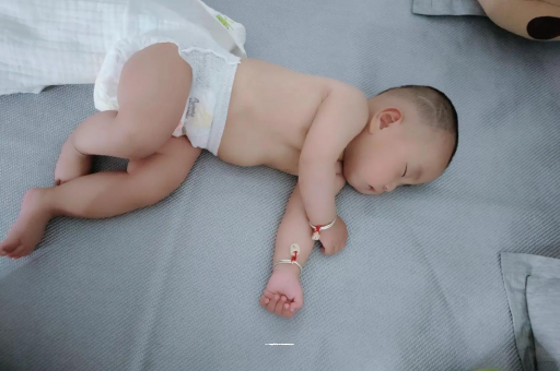 湘西宝宝头上长痱子 湘西宝宝头上长痱子